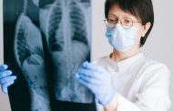 Gravedad en pacientes con fibrosis pulmonar idiopática es muy alta si se contagian de Covid-19