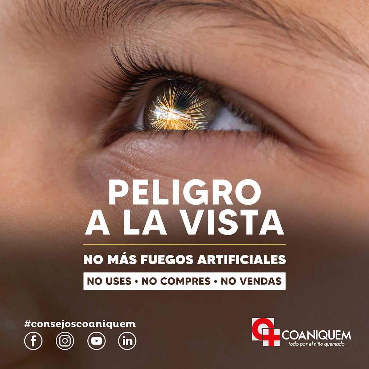 Campaña No más Fuegos Artificiales: Trabajo de COANIQUEM permite que las Quemaduras por Fuegos Artificiales en niños disminuyera en un 90%